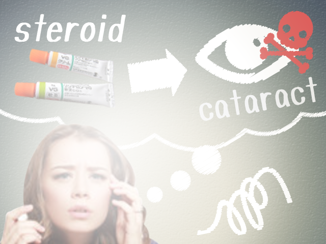 steroid_cataract